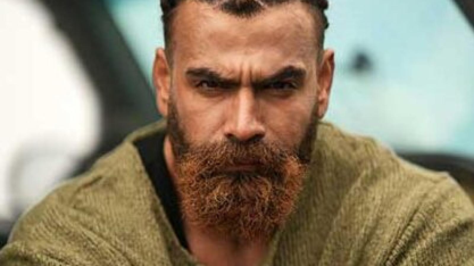 دانلود آهنگ معین زد خوابم نمیبره / من اینجامو تو اونجایی چرا دوریم یه عالمه